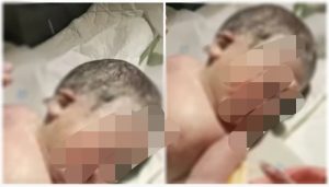 Bayi Bermata Satu Menghebohkan RSUD Sekayu, Muba, Sumsel. (Poto: ist)